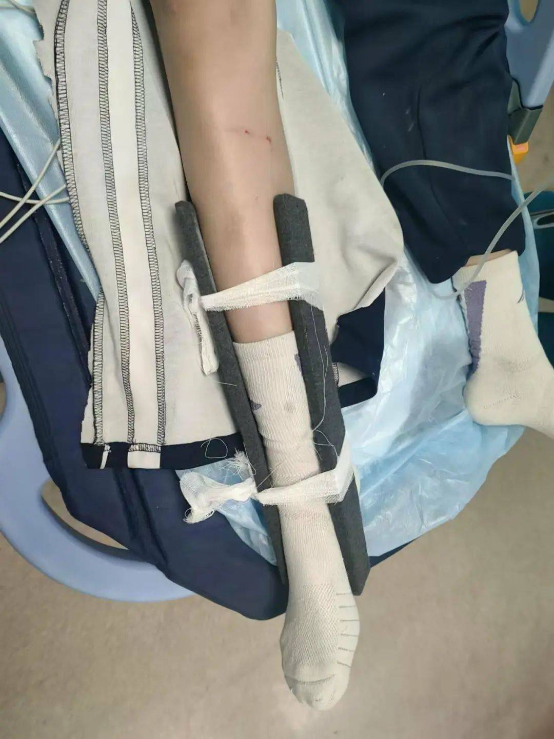 惨痛<strong></p>
<p>证券题</strong>！一人身亡！深圳多名学生骑电动车发生意外