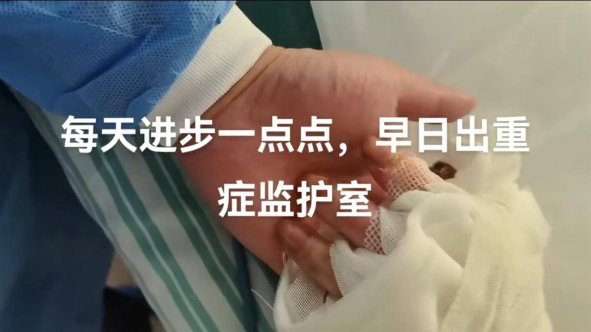 “烧伤妈妈”术后首次开口说话<strong></p>
<p>有哪些证券公司</strong>，称一辈子的苦都吃完了，其丈夫已开始带货，512件好物有497人跟买