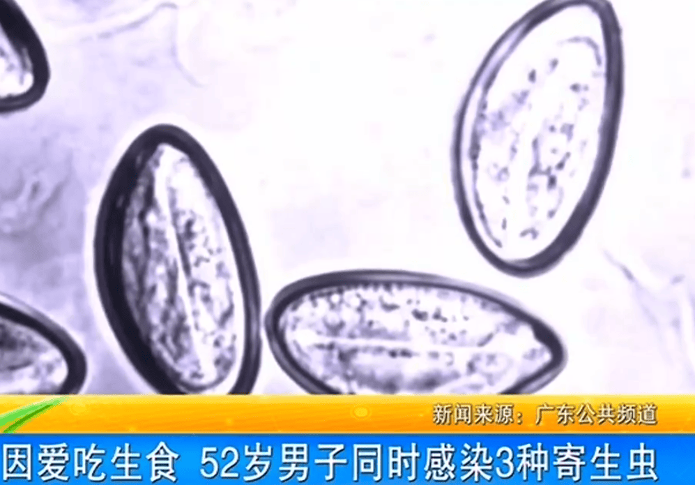 女子体内排出10米长绦虫<strong></p>
<p>证券投顾</strong>！原是两年前旅游时吃了这种食物