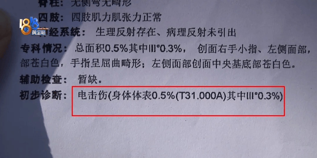 5岁男童瞬间晕厥<strong></p>
<p>证券公司工作</strong>，筋都断了！街上常见，看见立即远离