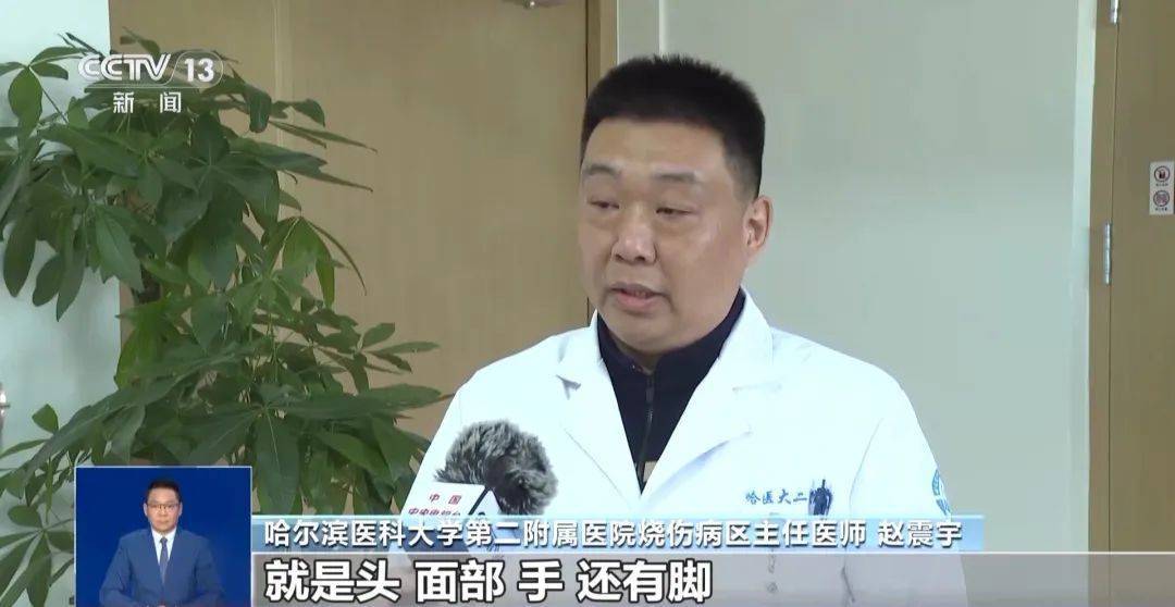 南方游客在哈尔滨“泼水成冰”受伤<strong></p>
<p>深圳证券交易</strong>！最新提醒