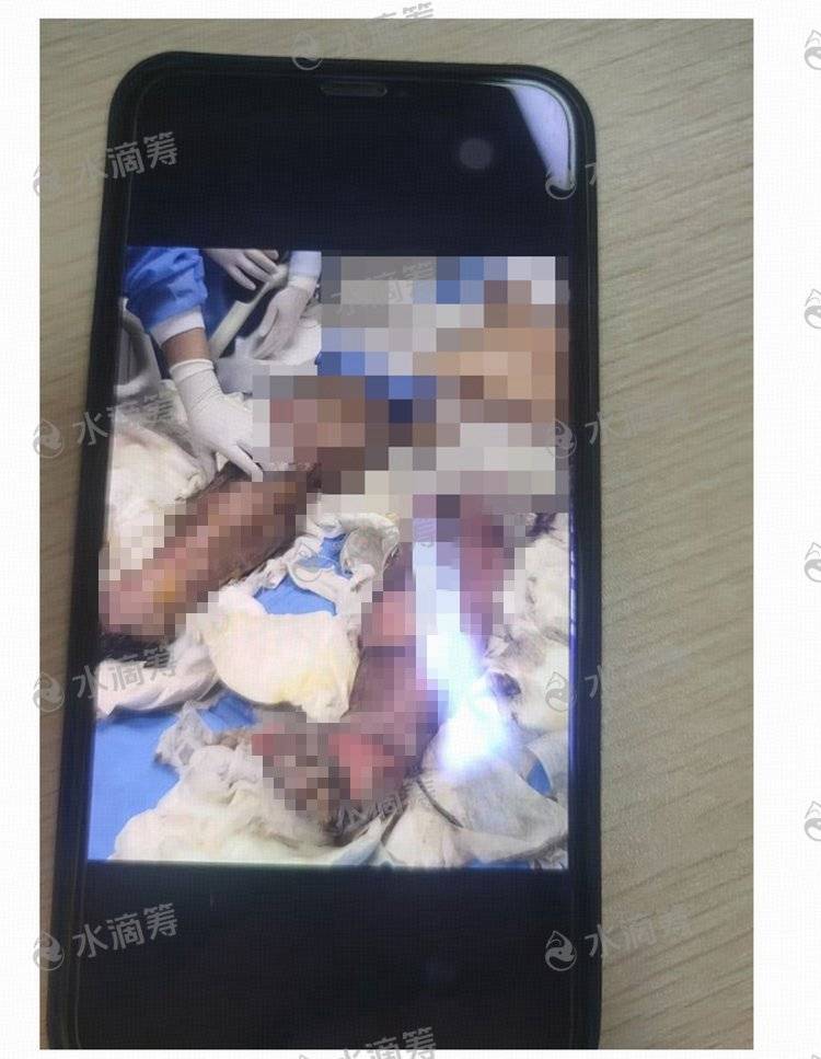 成都一小区电瓶车楼道“飞线充电”酿火灾<strong></p>
<p>证券行情</strong>，一家四口1死2伤，涉事车主被刑拘
