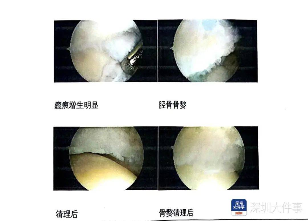 “一走路就痛”！女子脚踝受伤遭漏诊<strong></p>
<p>证券行情</strong>，治了7年没好！深圳一医院被告上法庭