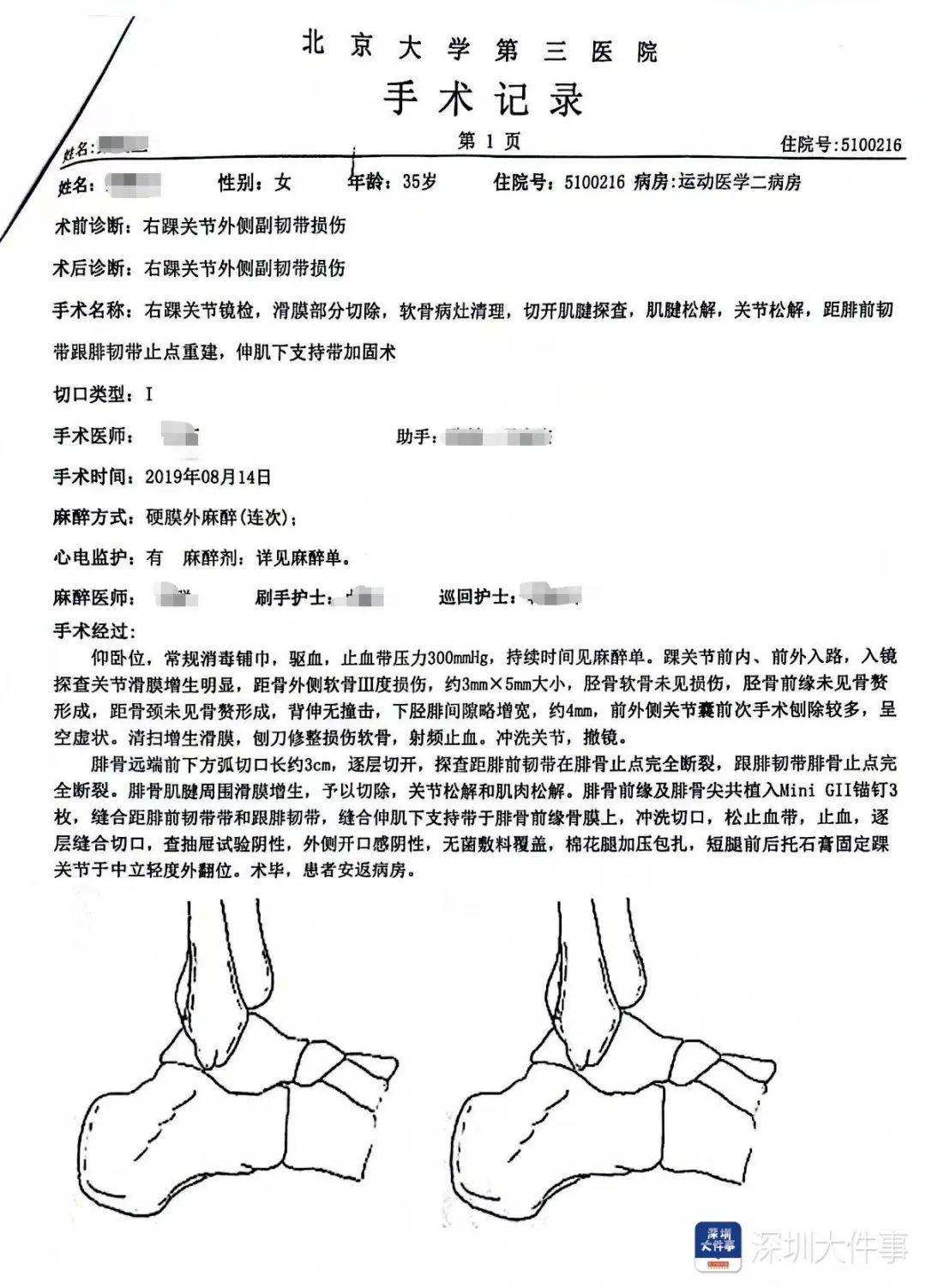 “一走路就痛”！女子脚踝受伤遭漏诊<strong></p>
<p>证券行情</strong>，治了7年没好！深圳一医院被告上法庭