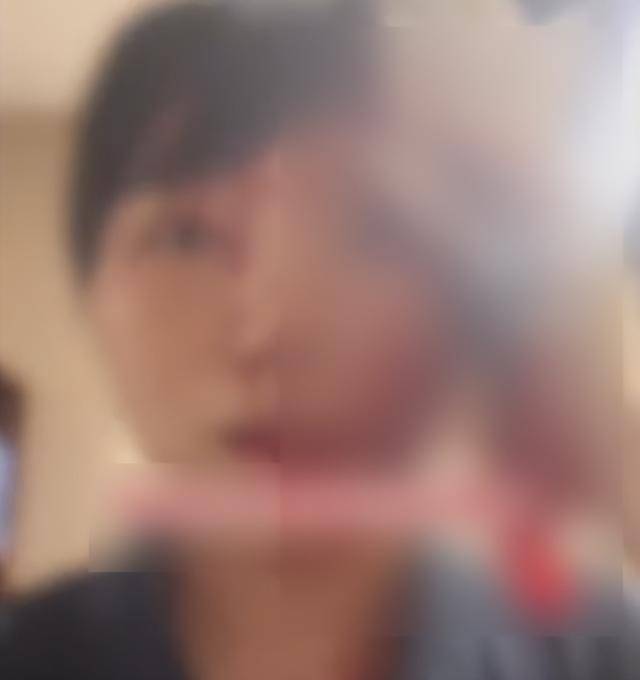 缝了20多针！女子称被不知名男同事砸头毁容<strong></p>
<p>沃尔核材股票股吧</strong>，警方介入